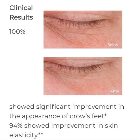 Perricone MD COLD PLASMA PLUS+ ADVANCED EYE CREAM - Picture 4 of 10